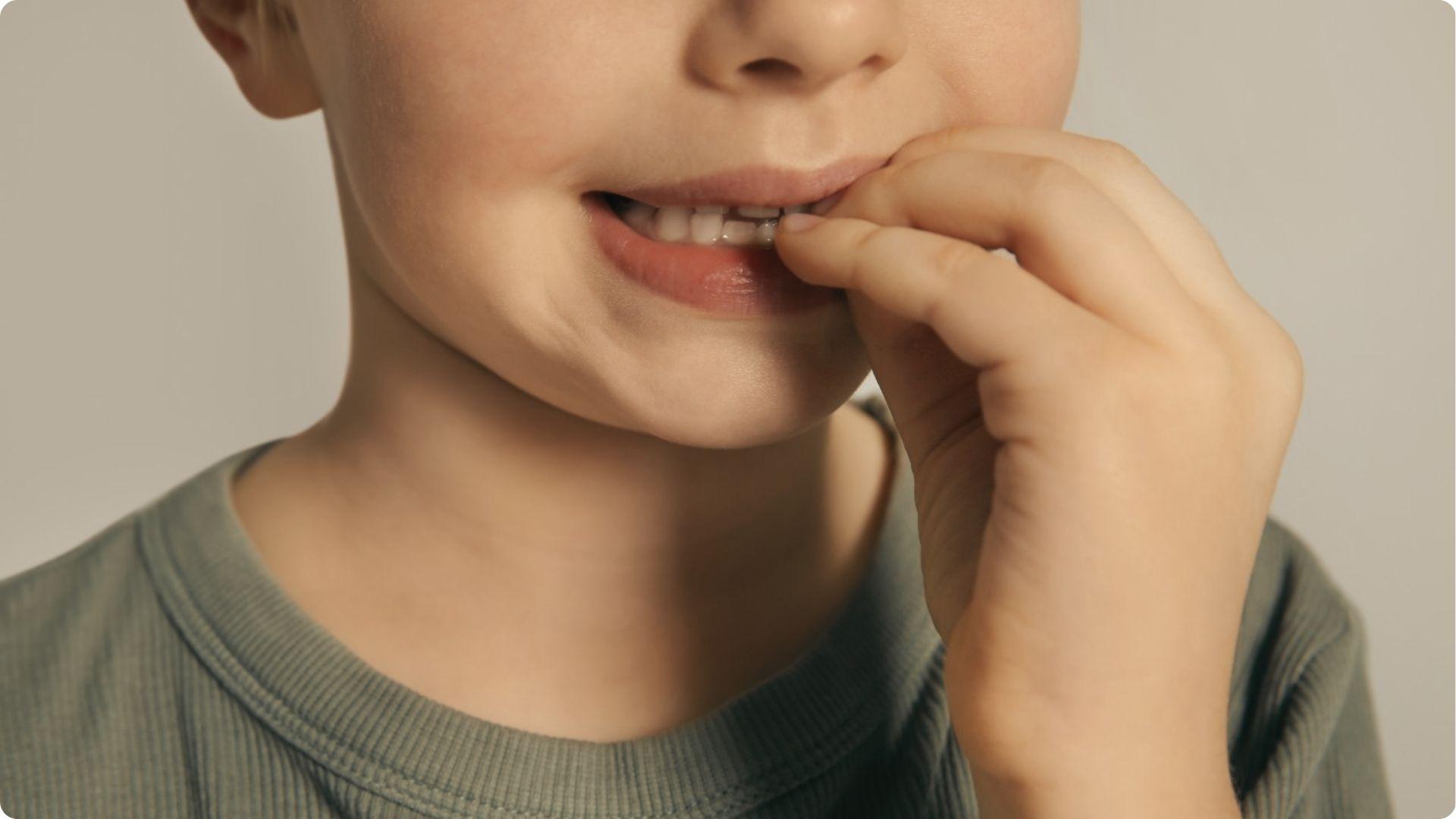 A young boy touches his grey tooth, which may need a dental checkup to rule out infection.