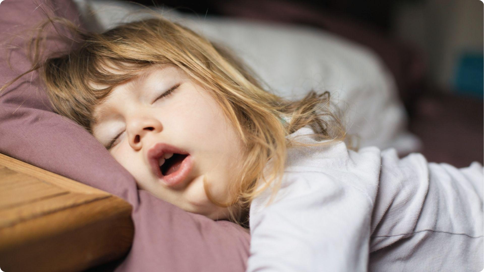 Child sleeps with mouth open on purple pillow, showing mouth breathing linked to pediatric sleep apnea.